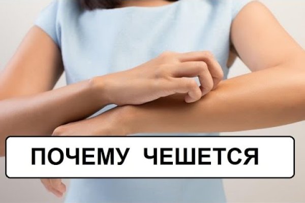 Гидра и кракен